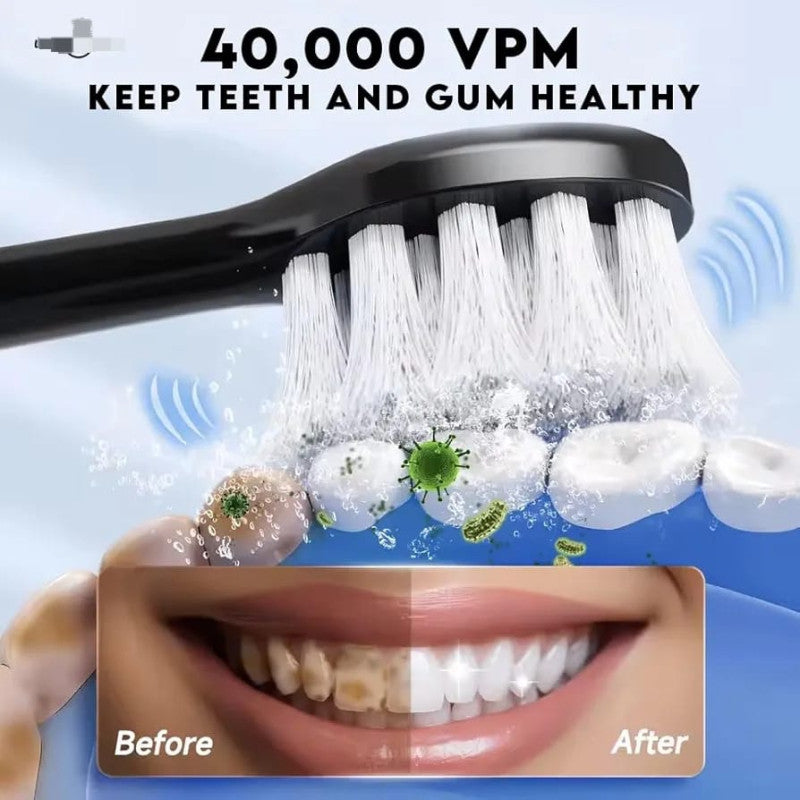 Sonic Electric Toothbrush – Smart Timer, Rechargeable, Waterproof, 4 Brush Heads